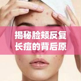 揭秘脸颊反复长痘的背后原因，如何科学应对痘痘频发问题？