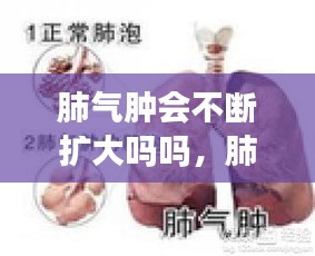 肺气肿会不断扩大吗吗，肺气肿会持续恶化吗 