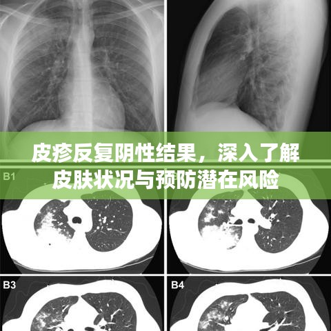 皮疹反复阴性结果，深入了解皮肤状况与预防潜在风险