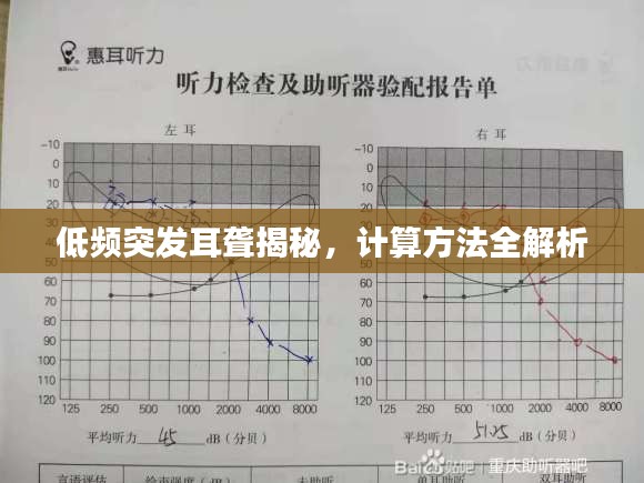 低频突发耳聋揭秘，计算方法全解析