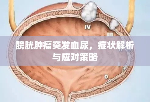 膀胱肿瘤突发血尿，症状解析与应对策略